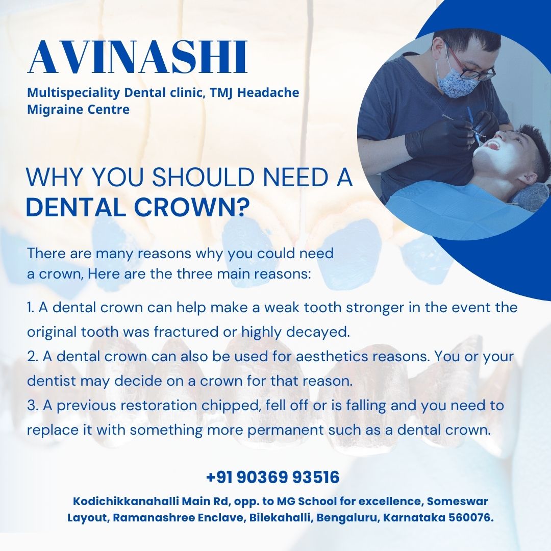 Avinashi Multispecialty Dental Cinic - Album - Dental Crowns or Cap