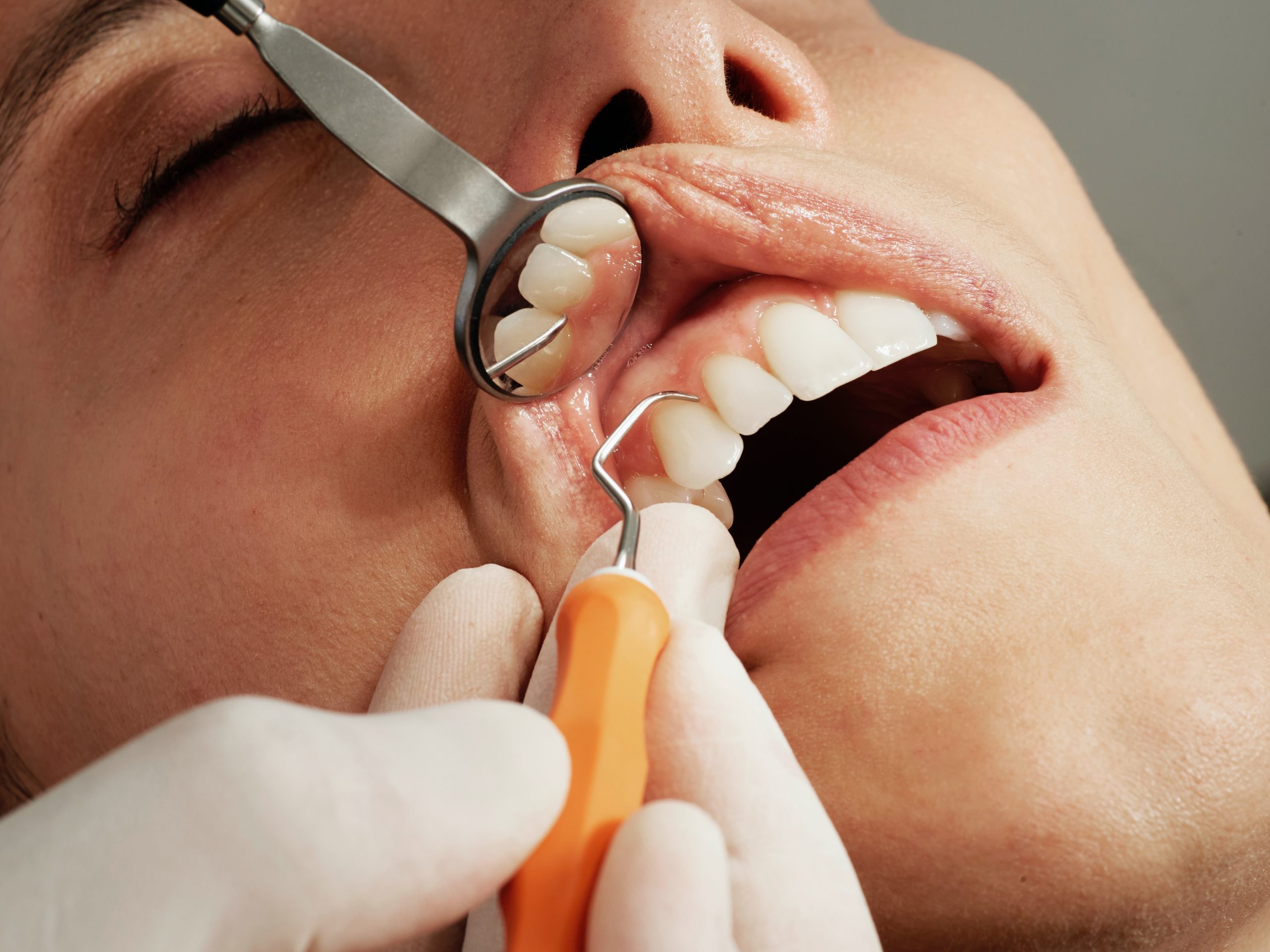 Avinashi Multispecialty Dental Cinic - Latest update - Dentist Near BTM Layout