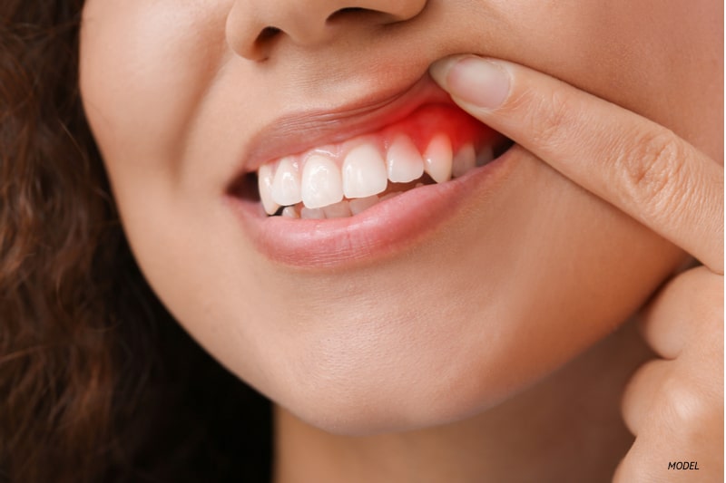 Avinashi Multispecialty Dental Cinic - Periodontics (Gum treatment)