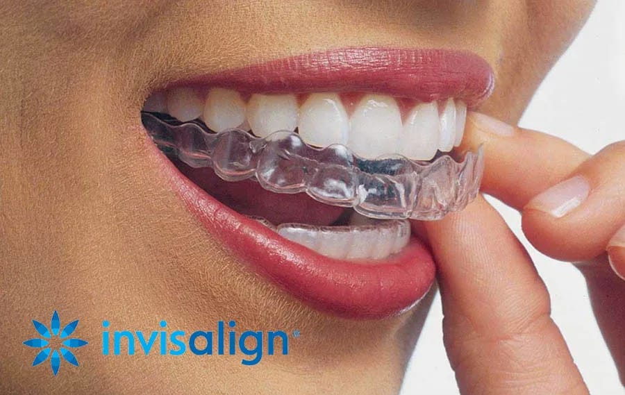 Avinashi Multispecialty Dental Cinic - Album - Invisalign