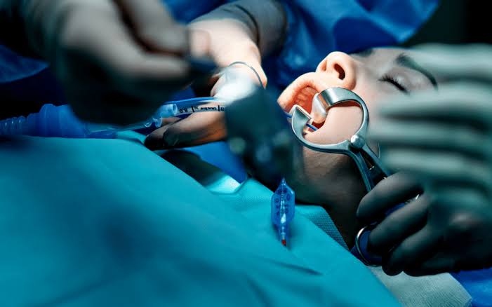 Avinashi Multispecialty Dental Cinic - Service - Oral Surgery