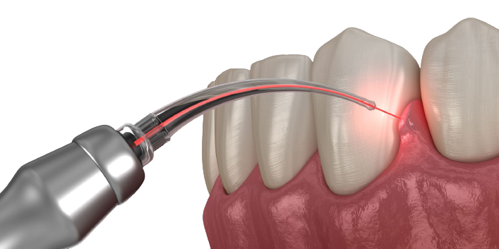 Avinashi Multispecialty Dental Cinic - Latest update - Best Laser Dentistry In Vijaya Bank Layout