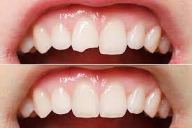 Avinashi Multispecialty Dental Cinic - Latest update - Best Cosmetic Dentistry