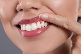 Avinashi Multispecialty Dental Cinic - Latest update - Dentist Near Vijaya Bank Layout