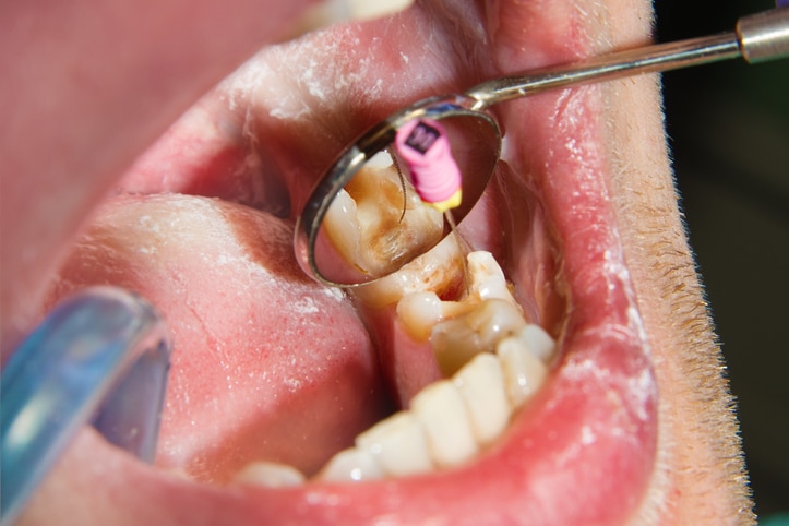 Avinashi Multispecialty Dental Cinic - Latest update - Dentist In BTM Layout